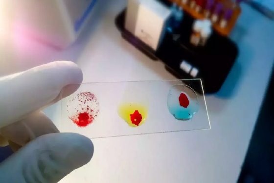 rajkotupdates. news_ mm-negative-rare-blood-group-found-in-rajkot-man-11th-such-case-worldwide