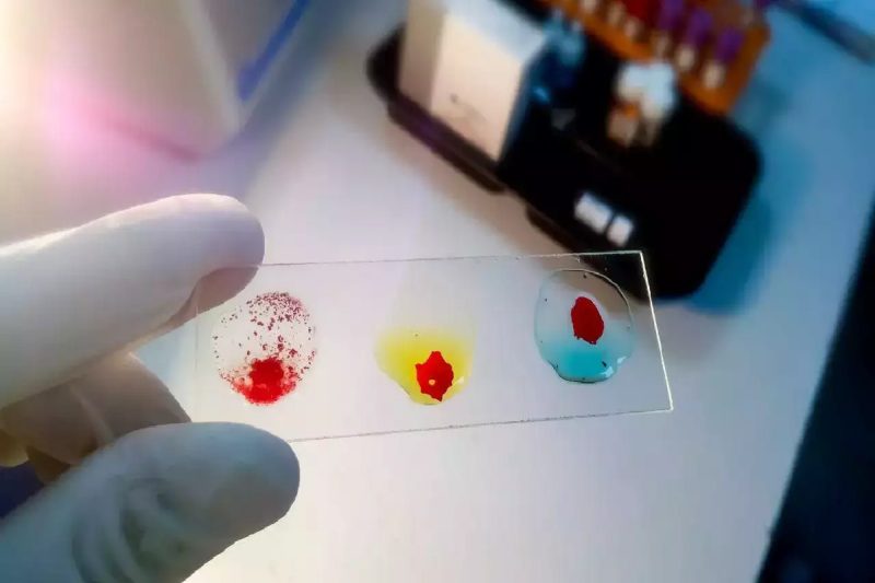 rajkotupdates. news_ mm-negative-rare-blood-group-found-in-rajkot-man-11th-such-case-worldwide